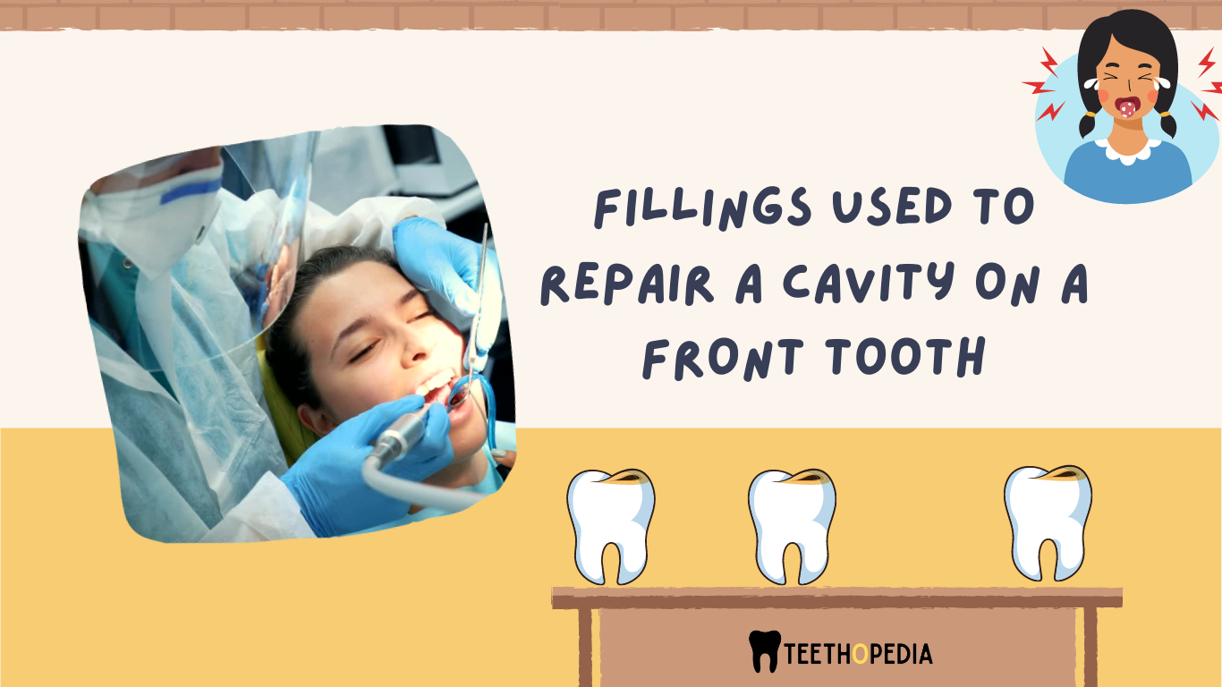 cavity on a front tooth
